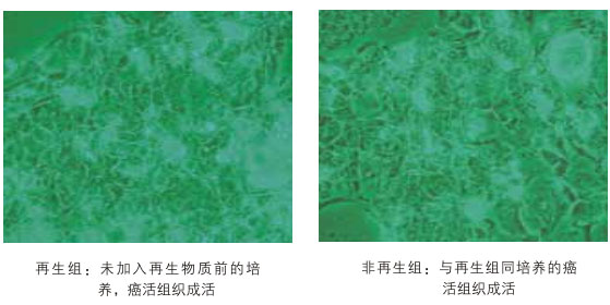 2011218171618243